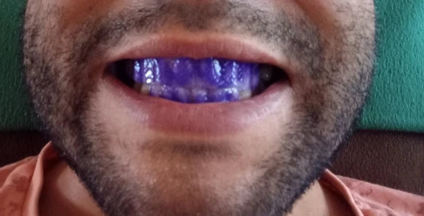 Review Card