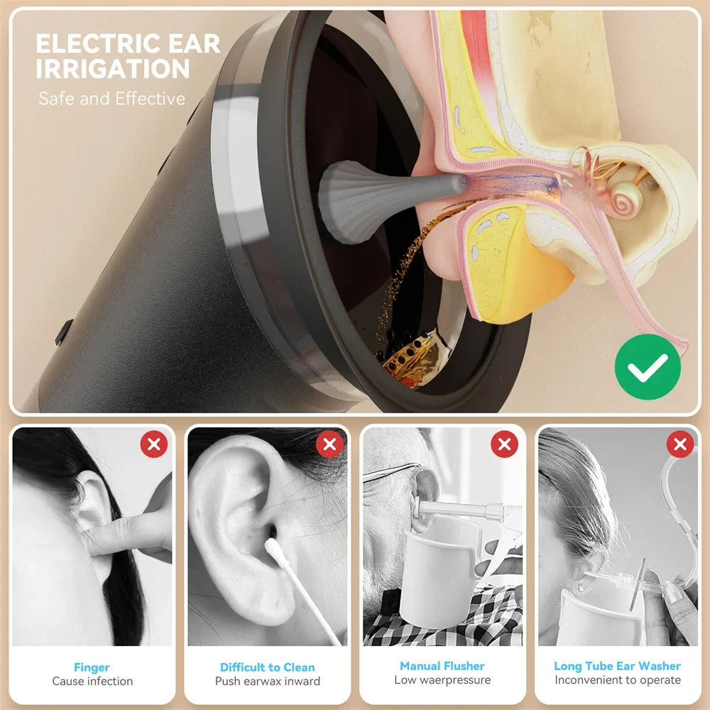 Electric Ear Wax Removal System